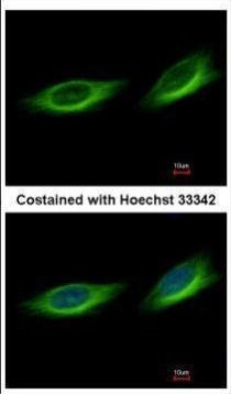 TULP1 Antibody in Immunocytochemistry (ICC/IF)