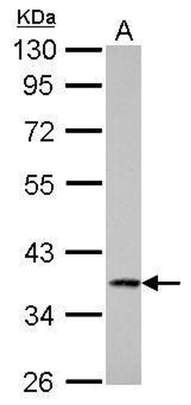 Cathepsin S Antibody in Western Blot (WB)