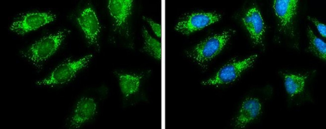 PDHA1 Antibody in Immunocytochemistry (ICC/IF)