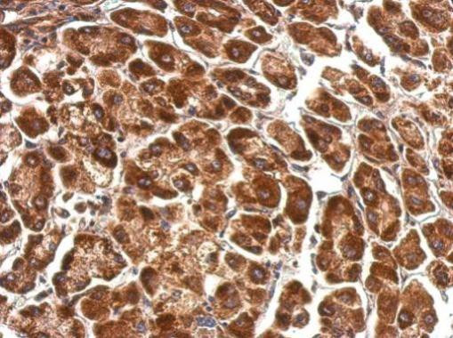 PDHA1 Antibody in Immunohistochemistry (Paraffin) (IHC (P))