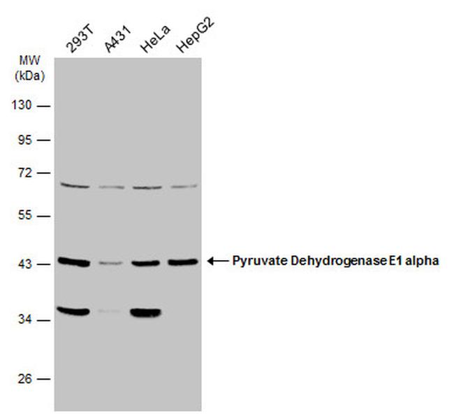 PDHA1 Antibody in Western Blot (WB)