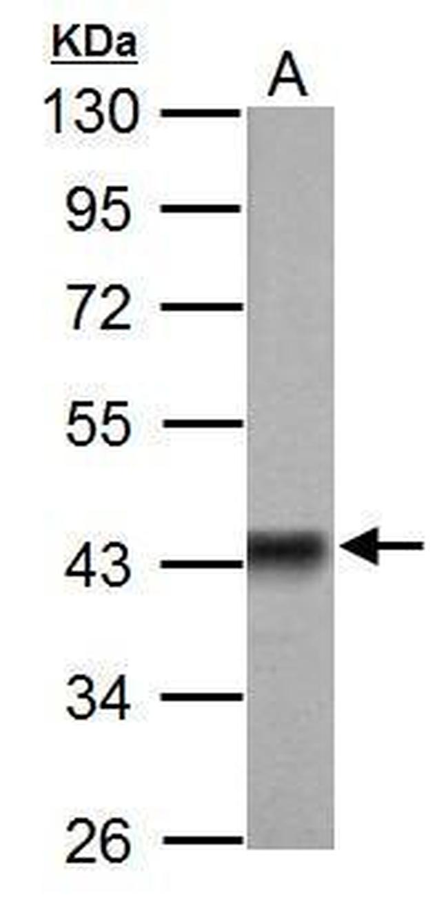 PDHA1 Antibody in Western Blot (WB)