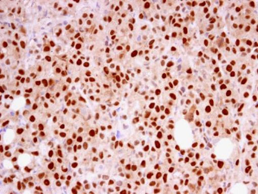 RFC4 Antibody in Immunohistochemistry (Paraffin) (IHC (P))