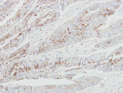 GALNT2 Antibody in Immunohistochemistry (Paraffin) (IHC (P))