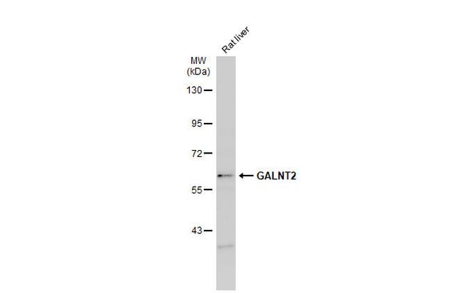 GALNT2 Antibody in Western Blot (WB)