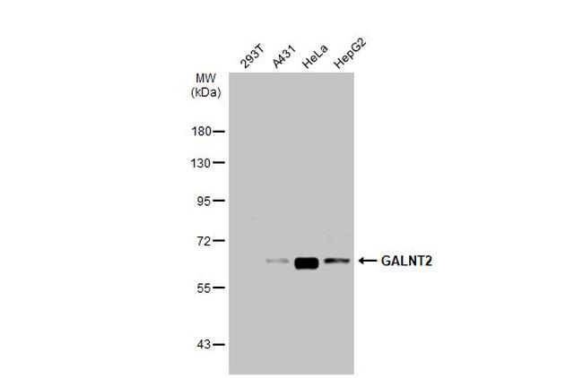 GALNT2 Antibody in Western Blot (WB)