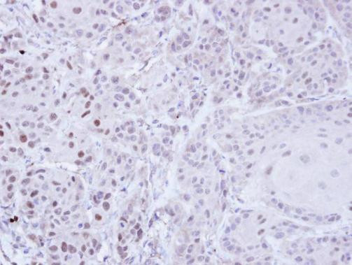 ZNF165 Antibody in Immunohistochemistry (Paraffin) (IHC (P))