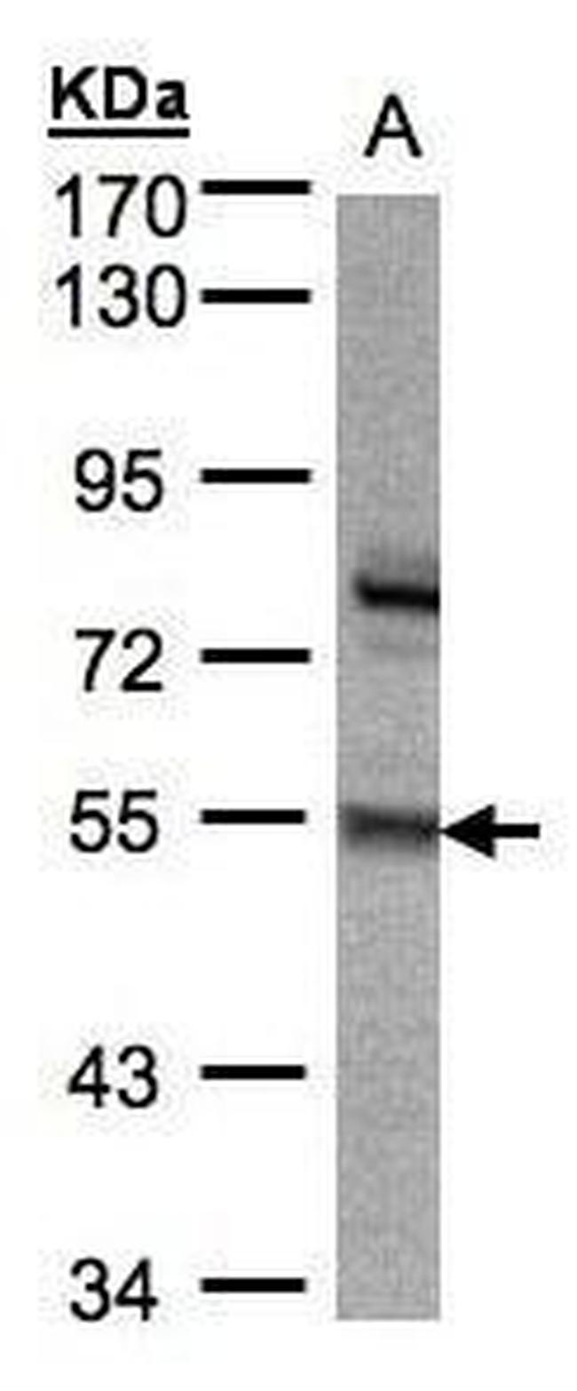 ZNF165 Antibody in Western Blot (WB)