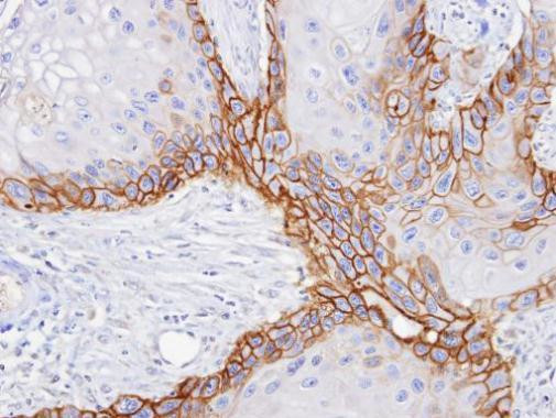 CD98 Antibody in Immunohistochemistry (Paraffin) (IHC (P))