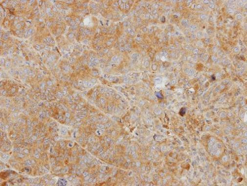 CHI3L2 Antibody in Immunohistochemistry (Paraffin) (IHC (P))