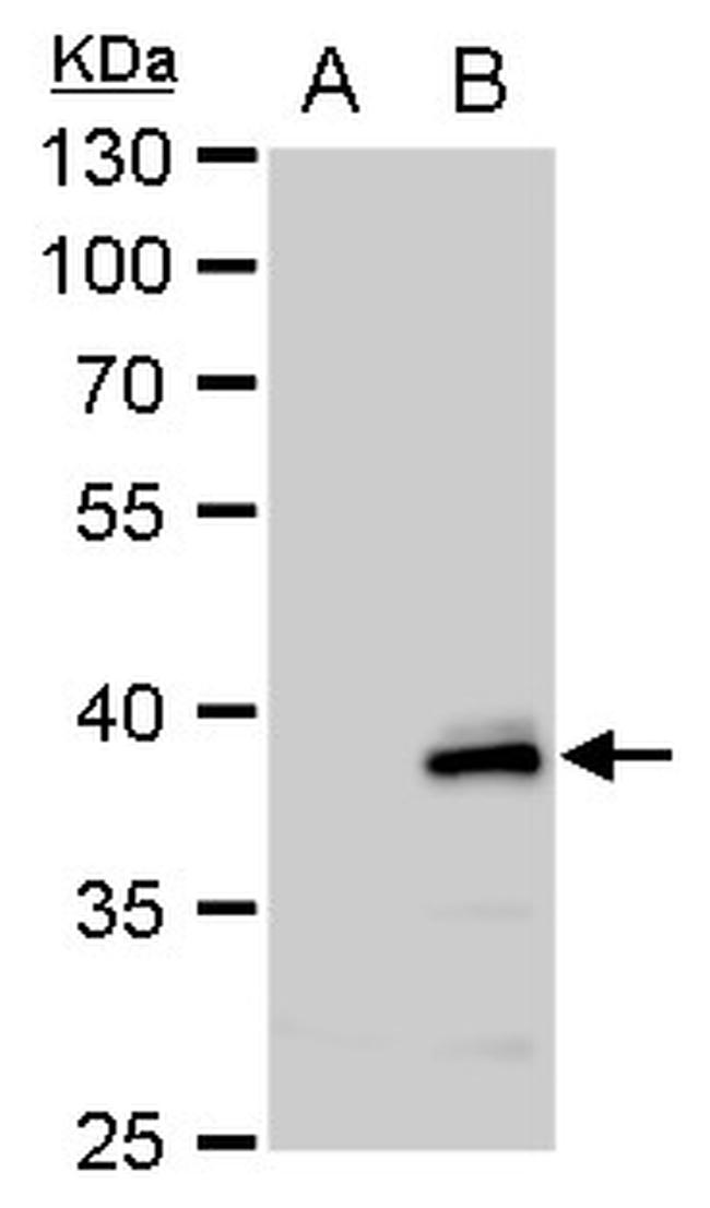 CHI3L2 Antibody in Western Blot (WB)