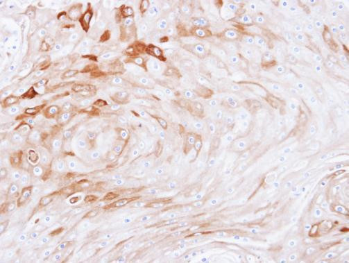 BCAT2 Antibody in Immunohistochemistry (Paraffin) (IHC (P))