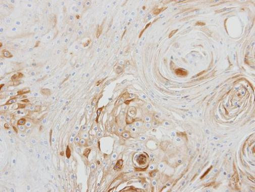 BCAT2 Antibody in Immunohistochemistry (Paraffin) (IHC (P))