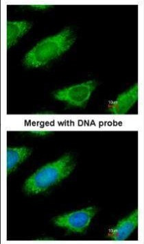 ME1 Antibody in Immunocytochemistry (ICC/IF)