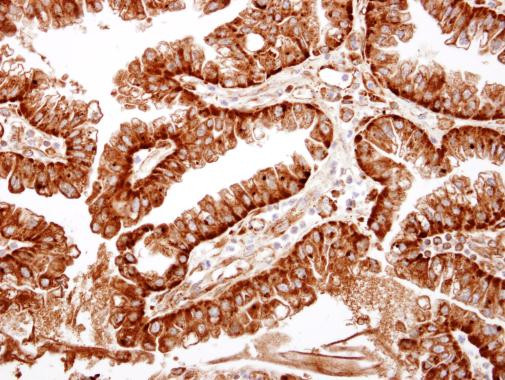 ME1 Antibody in Immunohistochemistry (Paraffin) (IHC (P))