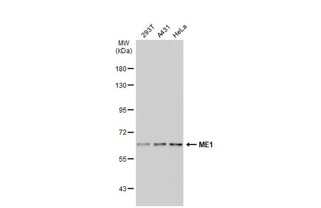 ME1 Antibody in Western Blot (WB)