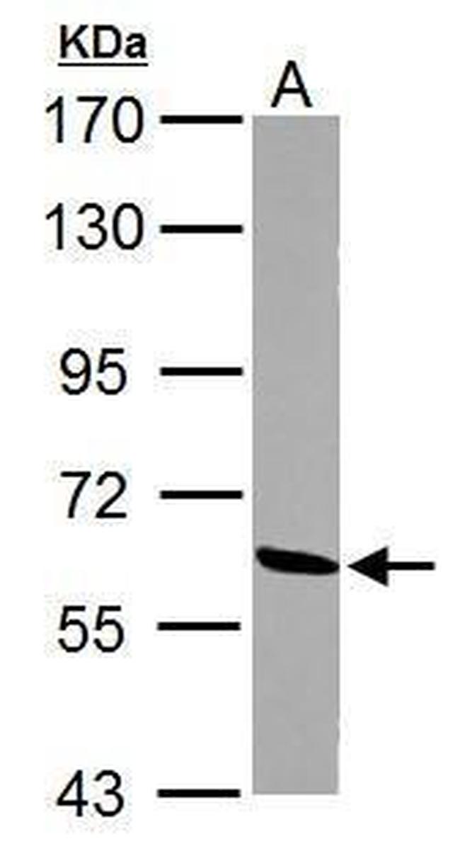 ME1 Antibody in Western Blot (WB)