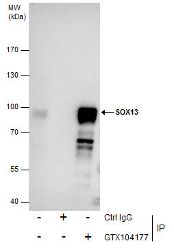 SOX13 Antibody in Immunoprecipitation (IP)