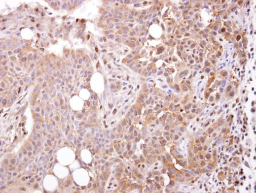 STOML1 Antibody in Immunohistochemistry (Paraffin) (IHC (P))