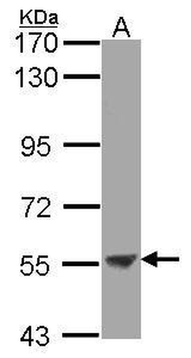 ENTPD3 Antibody in Western Blot (WB)