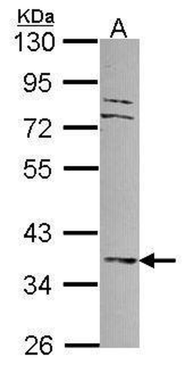 MKP3 Antibody in Western Blot (WB)