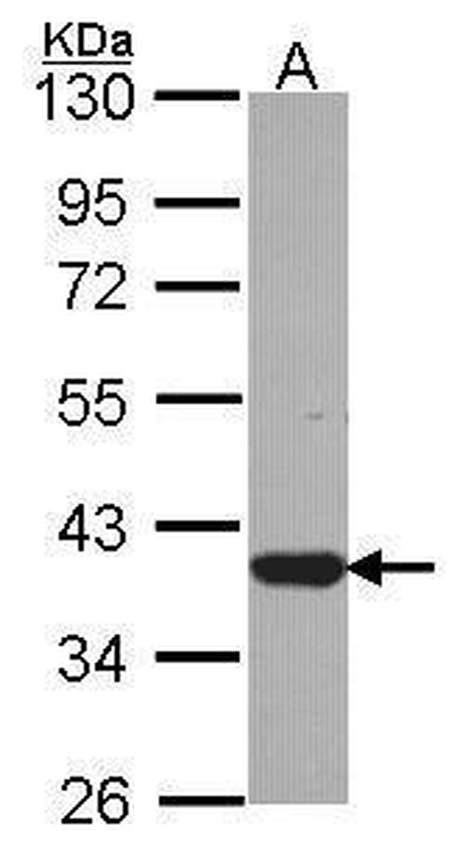 LZTFL1 Antibody in Western Blot (WB)