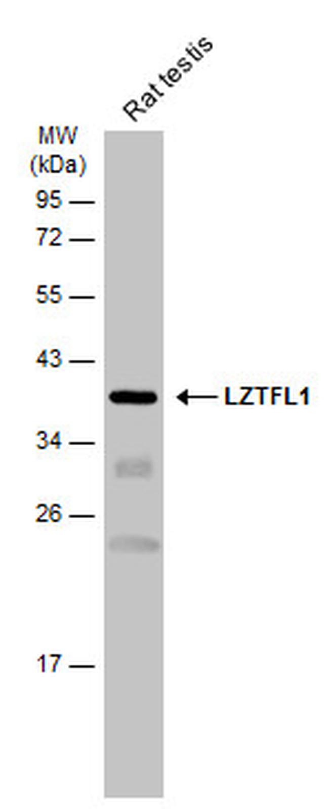 LZTFL1 Antibody in Western Blot (WB)