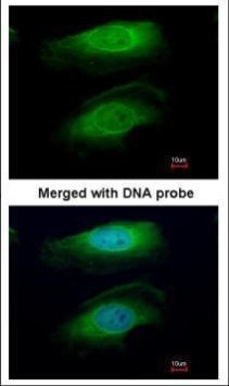 RICTOR Antibody in Immunocytochemistry (ICC/IF)