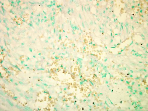 RICTOR Antibody in Immunohistochemistry (IHC)