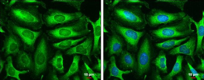 TPI1 Antibody in Immunocytochemistry (ICC/IF)