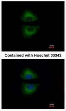 GRAP Antibody in Immunocytochemistry (ICC/IF)