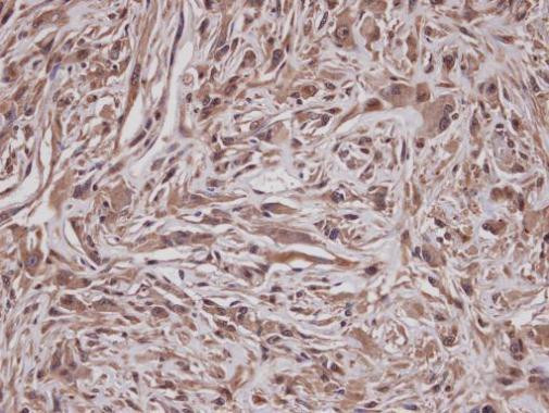 GRAP Antibody in Immunohistochemistry (Paraffin) (IHC (P))