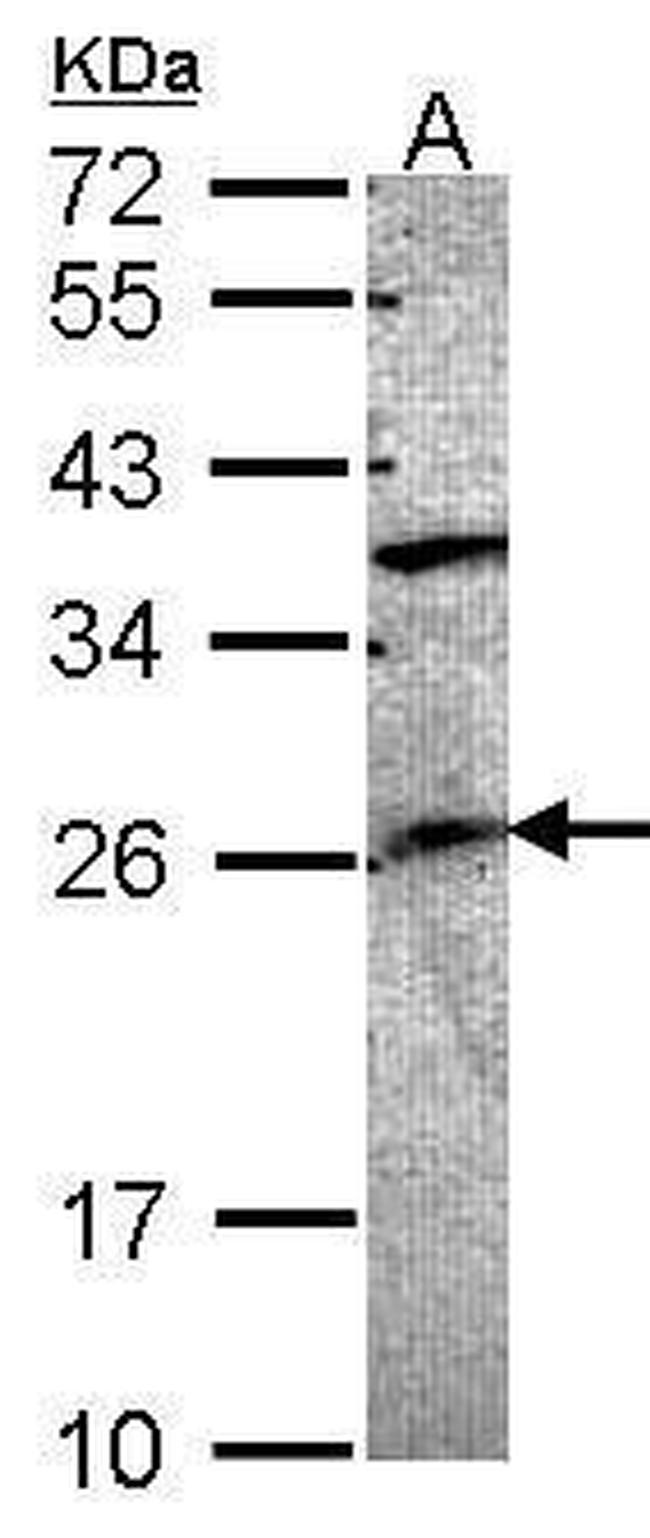 GRAP Antibody in Western Blot (WB)