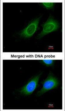 15-PGDH Antibody in Immunocytochemistry (ICC/IF)