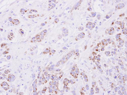 15-PGDH Antibody in Immunohistochemistry (Paraffin) (IHC (P))