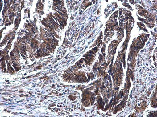 SDHB Antibody in Immunohistochemistry (Paraffin) (IHC (P))