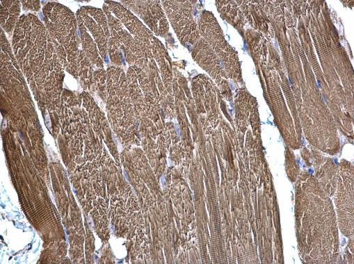 SDHB Antibody in Immunohistochemistry (Paraffin) (IHC (P))