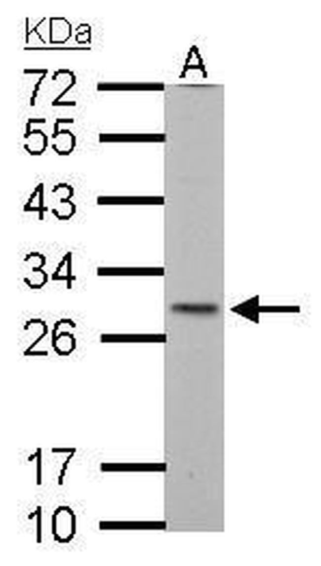 SDHB Antibody in Western Blot (WB)