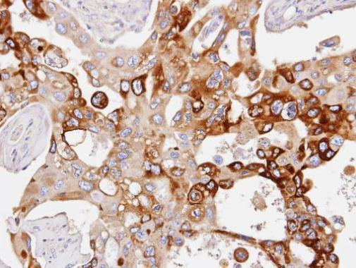 PDE4D Antibody in Immunohistochemistry (Paraffin) (IHC (P))