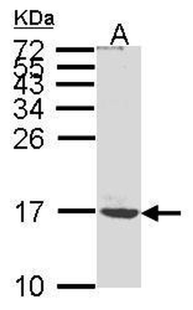 ATP5G1 Antibody in Western Blot (WB)