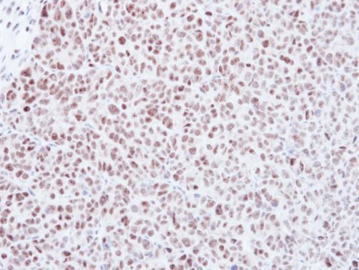 MAD2 Antibody in Immunohistochemistry (Paraffin) (IHC (P))