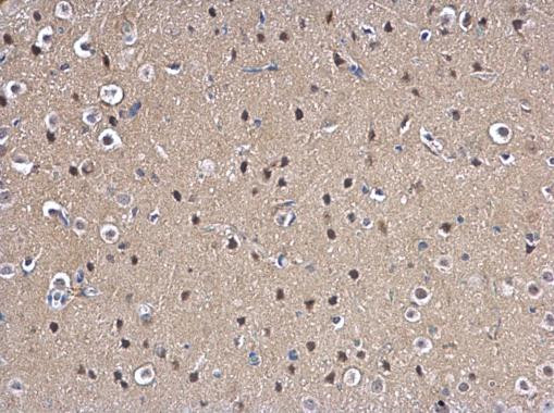 MAD2 Antibody in Immunohistochemistry (Paraffin) (IHC (P))