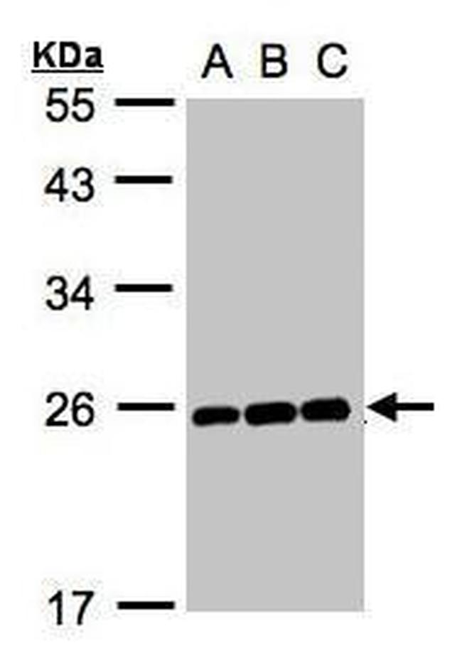 MAD2 Antibody in Western Blot (WB)