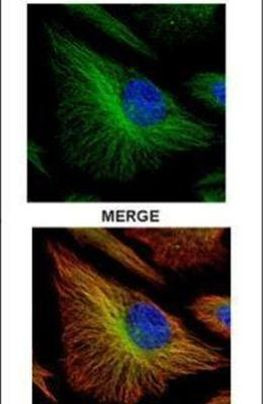 TRADD Antibody in Immunocytochemistry (ICC/IF)