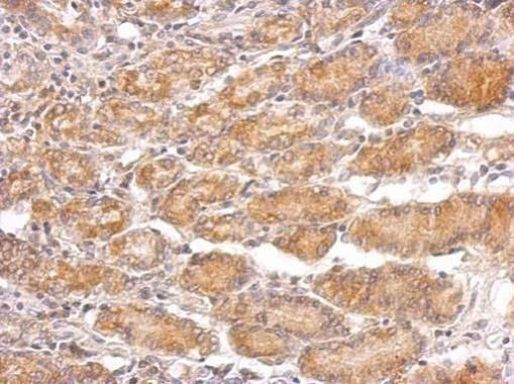 TRADD Antibody in Immunohistochemistry (Paraffin) (IHC (P))