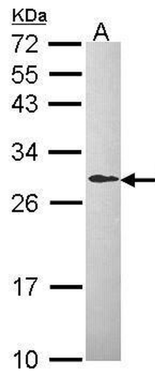 DCXR Antibody in Western Blot (WB)