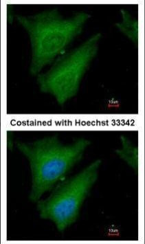 SOCS4 Antibody in Immunocytochemistry (ICC/IF)