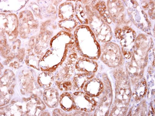 SOCS4 Antibody in Immunohistochemistry (Paraffin) (IHC (P))