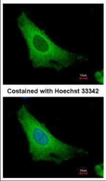 ARF3 Antibody in Immunocytochemistry (ICC/IF)