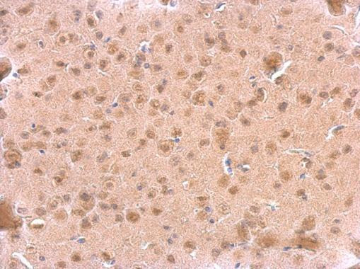 ARF3 Antibody in Immunohistochemistry (Paraffin) (IHC (P))